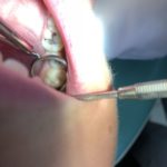 Kierunek higienistka stomatologiczna w Kościerzynie wykonywanie przeglądów stomatologicznych