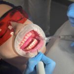 Higienistka stomatologiczna - szkolenie