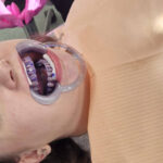 Higienistki Stomatologiczne podczas zajęć praktycznych